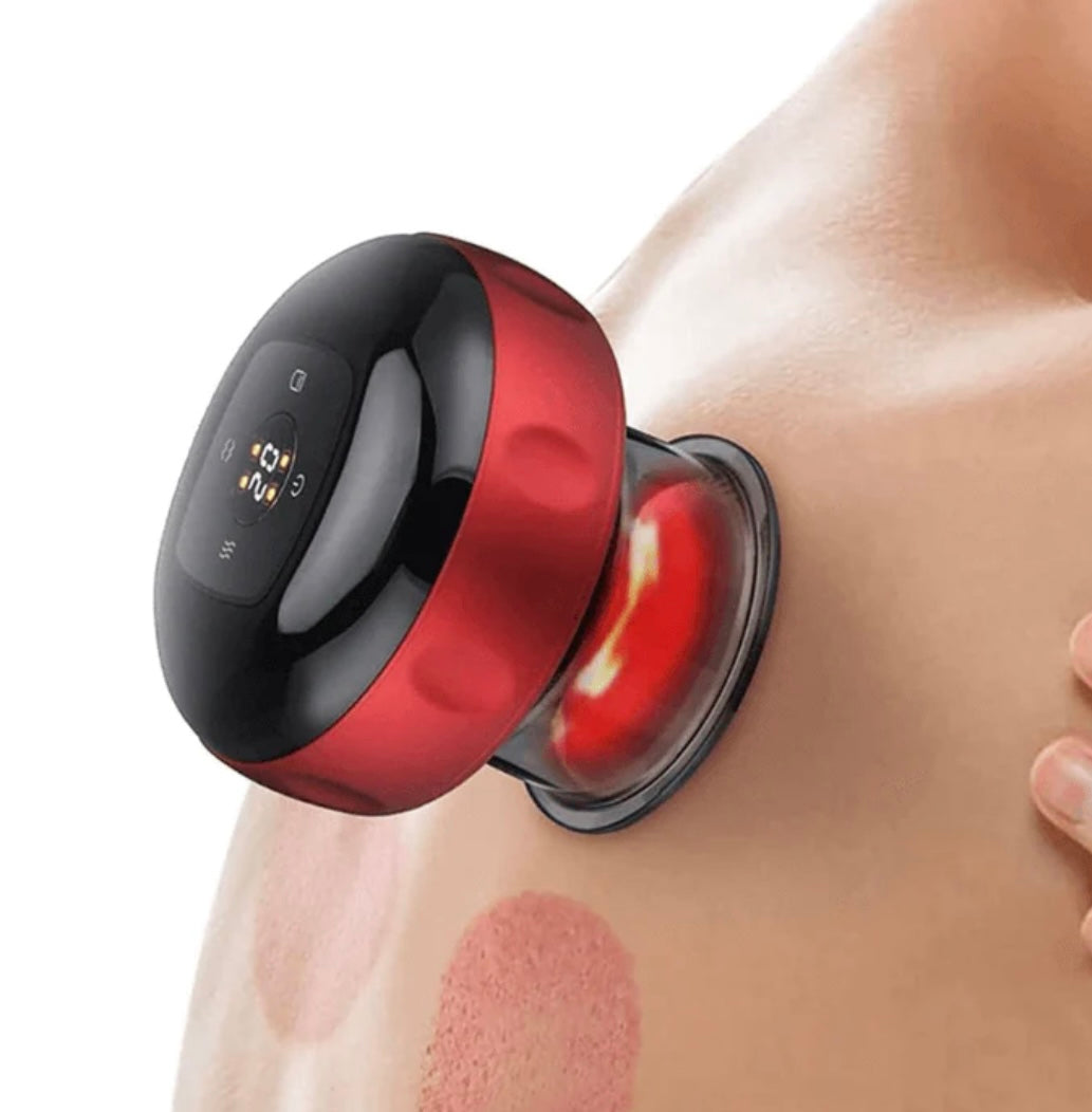 Electric Cupping Therapy | Muscle Relief